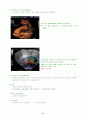 자궁근종(myoma) case study 5페이지