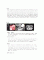 위암(Stomach Cancer) 3페이지