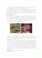 위암(Stomach Cancer) 7페이지
