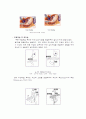위암케이스 스터디 4페이지