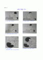 응급처치 6페이지