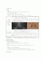 추간판 탈출증 3페이지