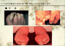 미생물에 의한 질병-파워포인트 11페이지