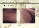 미생물에 의한 질병-파워포인트 12페이지