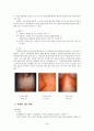 피부질환증상과치료 6페이지