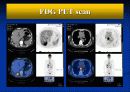 위암 환자 술후 case presentation 15페이지