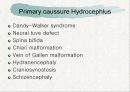 뇌수종 hydrocephalus 8페이지