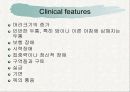 뇌수종 hydrocephalus 11페이지