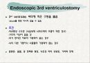 뇌수종 hydrocephalus 20페이지