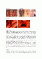 성병이란 6페이지