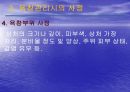 욕창관리 파워포인트 28페이지