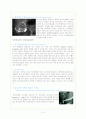 Laparoscopic cholecystectomy 4페이지