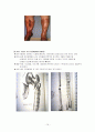 성인간호학 근골격계 손상 및 간호 (사진有) 16페이지