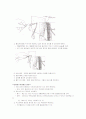 pleural effusion 14페이지
