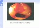청소년과 술 12페이지