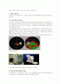 녹내장(Glaucoma)에 대한 정리 18페이지