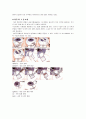 녹내장(Glaucoma)에 대한 정리 24페이지