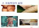 아동학대 보호사업의 문제점에 대한 대책 및 개선점 9페이지