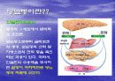 당뇨병의 개념과 원인 합병증 4페이지