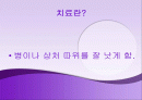 치료의 개념 2페이지