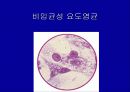 성병의 예방과 치료-치료시 유의점,성병의 종류 21페이지