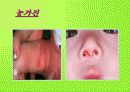 여러가지 어린이 응급질환에 대하여 3페이지
