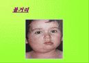 여러가지 어린이 응급질환에 대하여 9페이지