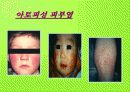 여러가지 어린이 응급질환에 대하여 17페이지