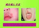 여러가지 어린이 응급질환에 대하여 29페이지