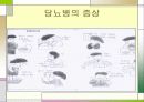 당뇨병과운동처방 9페이지