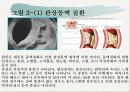 고지혈증 18페이지