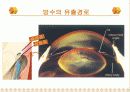 녹내장의 증상 및 치료 6페이지