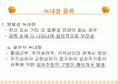 녹내장의 증상 및 치료 7페이지