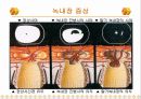 녹내장의 증상 및 치료 12페이지