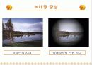 녹내장의 증상 및 치료 13페이지