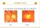 녹내장의 증상 및 치료 16페이지