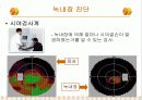 녹내장의 증상 및 치료 17페이지