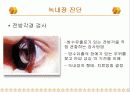 녹내장의 증상 및 치료 18페이지