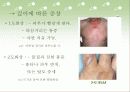 통풍,화상,빈혈 식사요법 15페이지