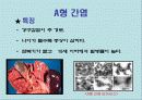 간염과 바이러스(A+레포트) 6페이지