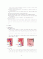 성인간호 신경외과 케이스 스터디 46페이지