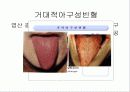 빈혈에 대하여 17페이지