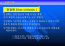 간경화증(간경변증) 에 관한 발표 자료 3페이지