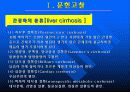간경화증(간경변증) 에 관한 발표 자료 4페이지