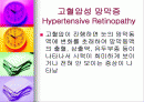 고혈압성 망막증 2페이지