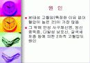 고혈압성 망막증 4페이지