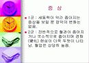 고혈압성 망막증 6페이지