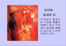 흡연과 알코올의 피해 17페이지
