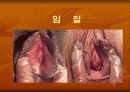 성인성 질환과 에이즈 4페이지