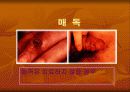성인성 질환과 에이즈 5페이지